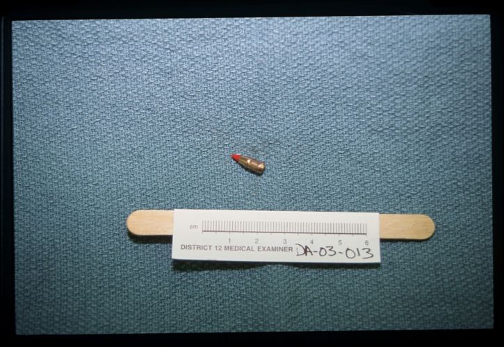picture of the bullet next to measuring tape as evidence