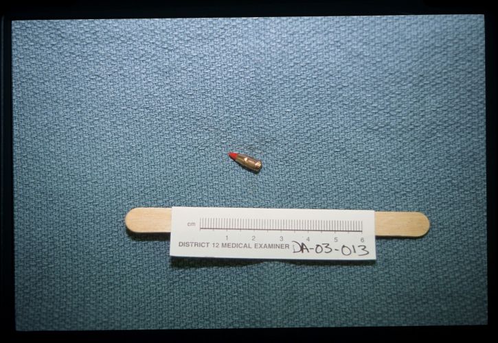 picture of the bullet next to measuring tape as evidence