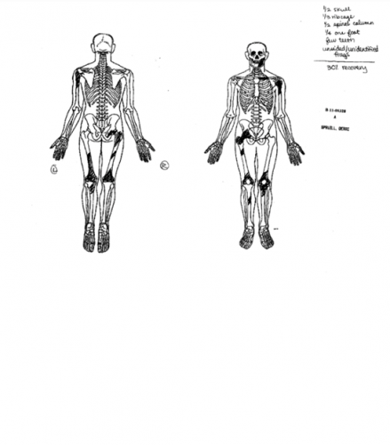 Guy Spruill’s Autopsy Report 4